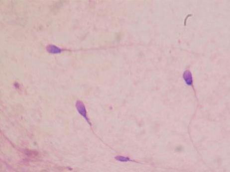 Ученые создали искусственную сперму из клеток кожи