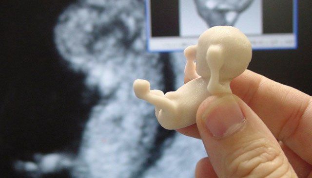 В США выработан метод 3D-диагностики зародыша